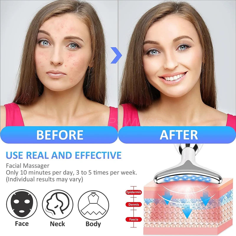 Facial Lifting Device
