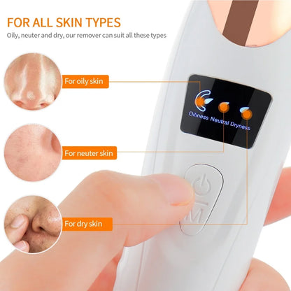 Vacuum Blackhead Remover