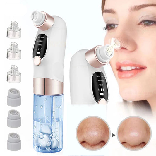 Vacuum Blackhead Remover for Smooth & Glowing Skin